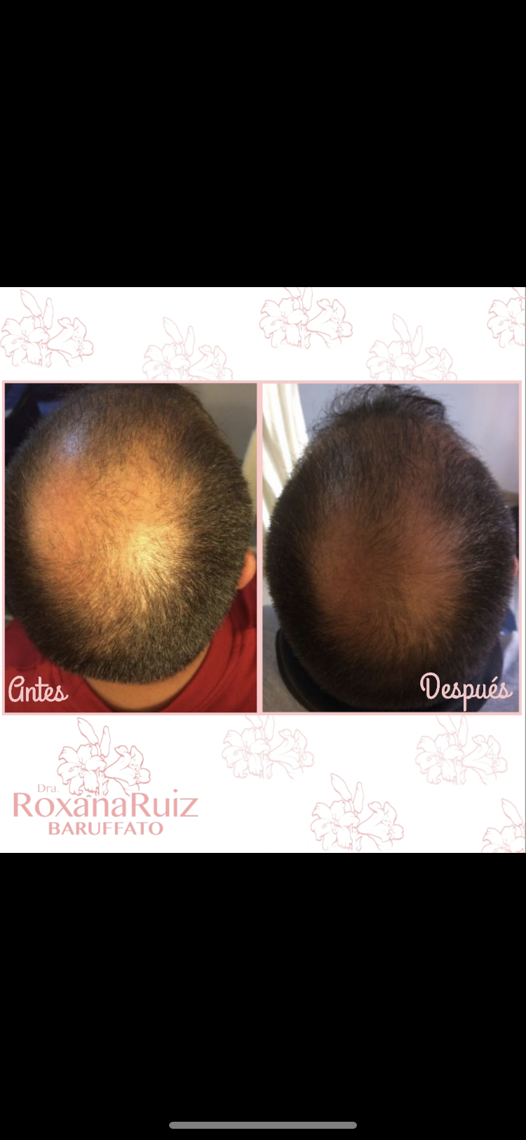 Medicina Estética a Domicilio. Avalada por la UBA