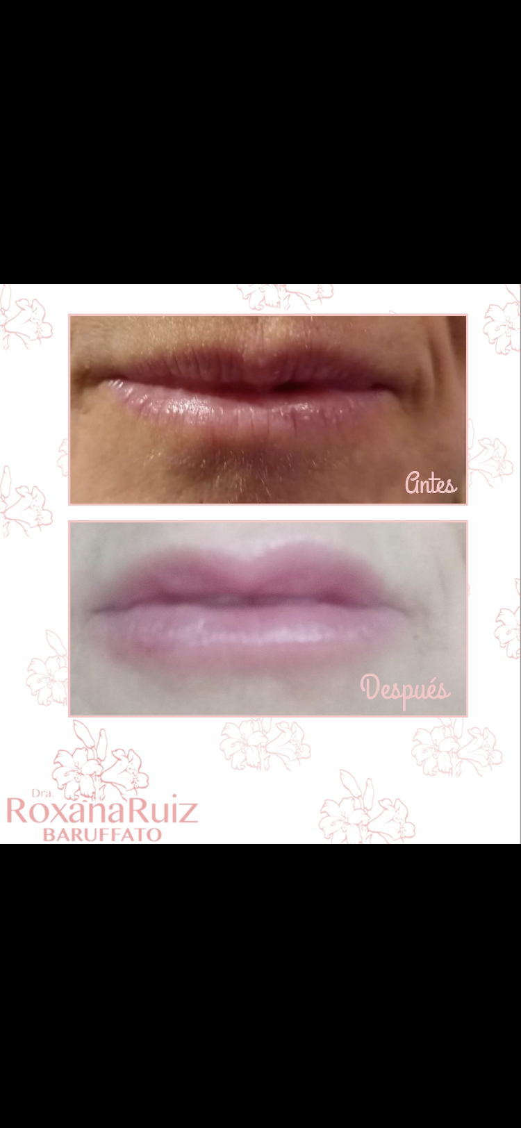 Medicina Estética a Domicilio. Avalada por la UBA